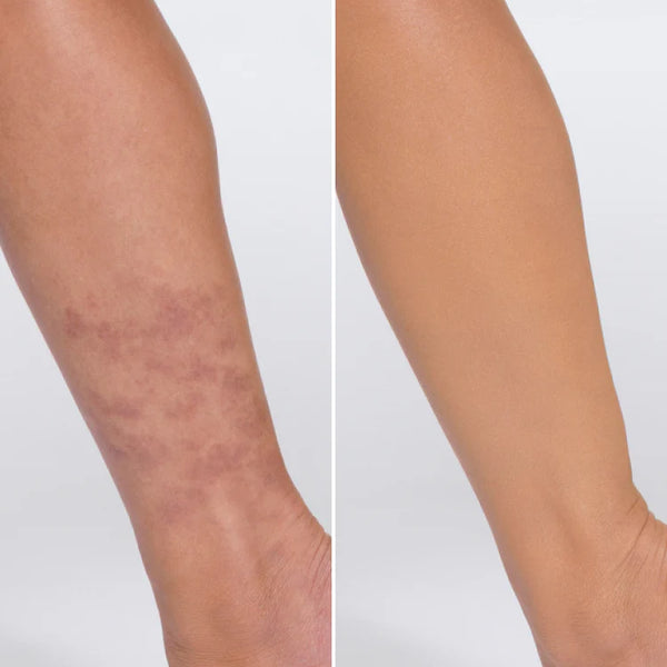 Dry, patchy skin