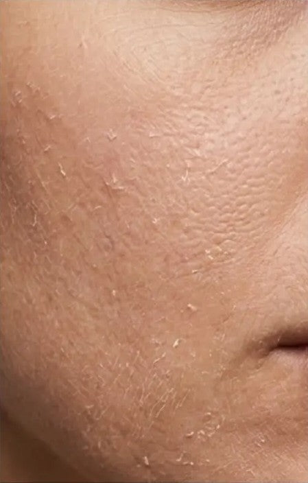 Dry, patchy skin